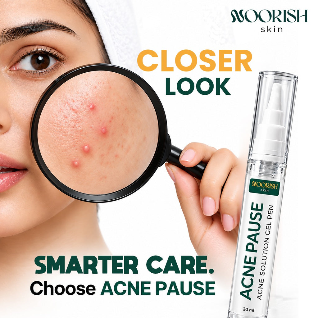 Noorish Skin Acne Pause – Acne Care Solution for Clearer-Looking Skin