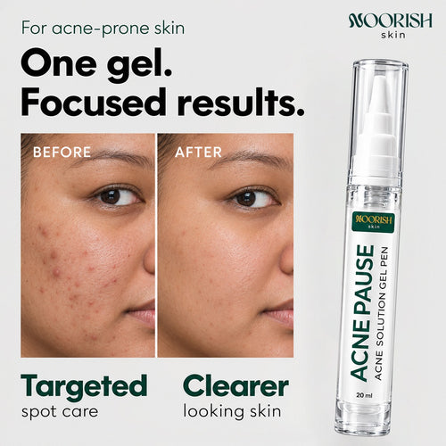 Noorish Skin Acne Pause – Acne Care Solution for Clearer-Looking Skin